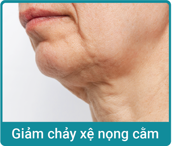 giam-chay-xe-nong-cam